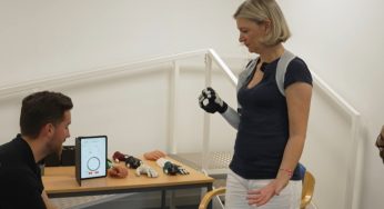 Woman Run Over by Two Trains Becomes First to Use AI Bionic Arm